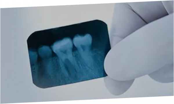 Periapical Radiolucencies (Online)