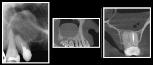 How to look at the paranasal sinuses and their pathologies (Online)