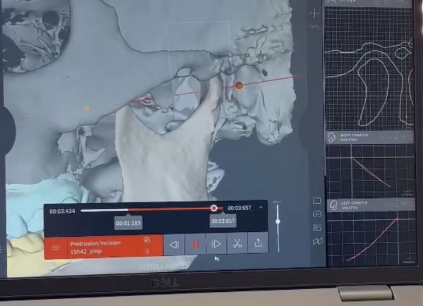 TMJ Disorder Management with Modjaw: From Diagnostic to Orthotic Appliances – January 17th and 18th 2025 in La Jolla – Limited Availability (Hands-on Course) (Onsite)