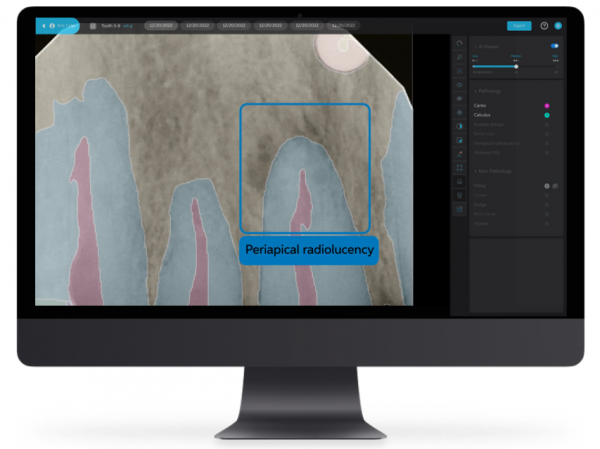 Formation dentistes et son équipe en Radiologie: Le CBCT: Quand le 2D n'est plus assez. Le 7 novembre 2025 à Saguenay (Onsite)