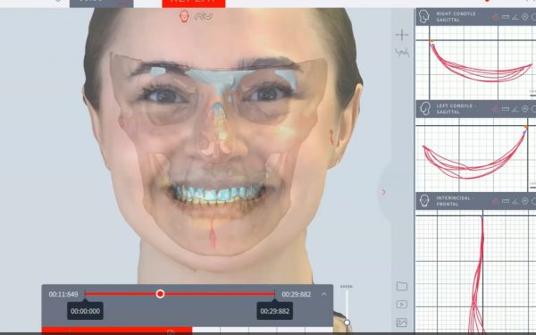 TMJ Disorder Management with Modjaw: From Diagnostic to Orthotic Appliances – May 23rd and 24th, 2025 in Montreal – Limited Availability (Hands-on Course) (Onsite)